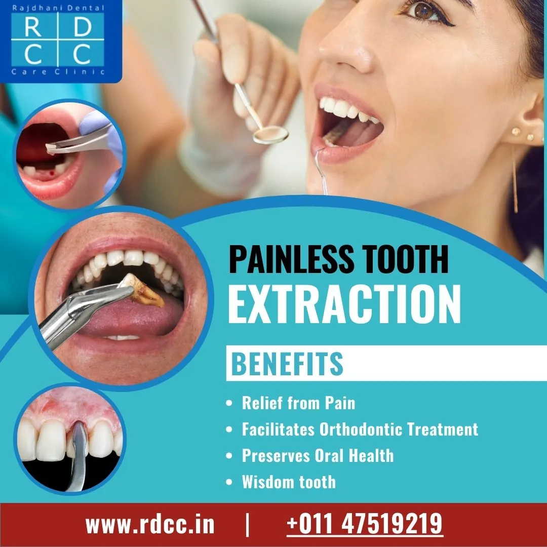 Painless Tooth Extraction in Preet Vihar