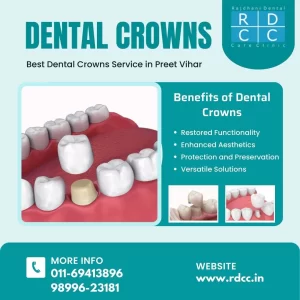 Best Dental Crowns Service in Preet Vihar