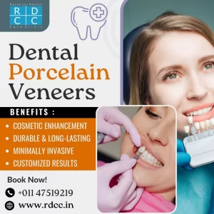 Enhance Your Smile: Dental Porcelain Veneers at RDCC Rajdhani Dental Care Clinic