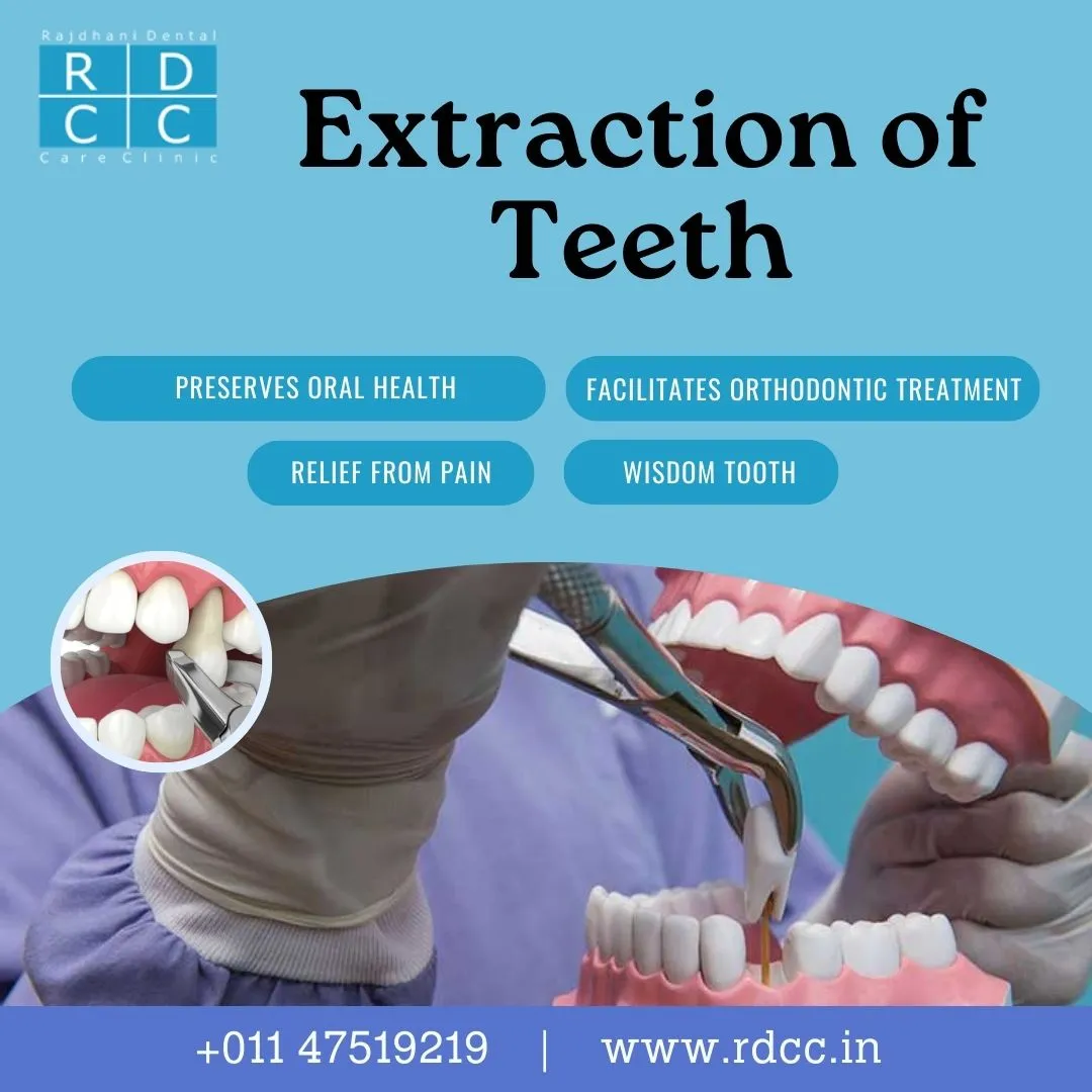 Teeth Extraction Advantages at Rajdhani Dental Care Clinic