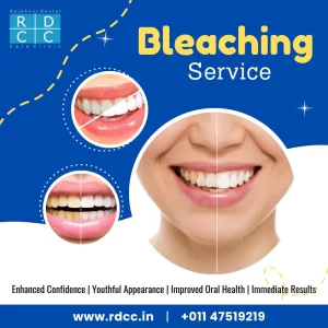 Teeth Whitening Treatment at Rajdhani Dental Care Clinic in Delhi